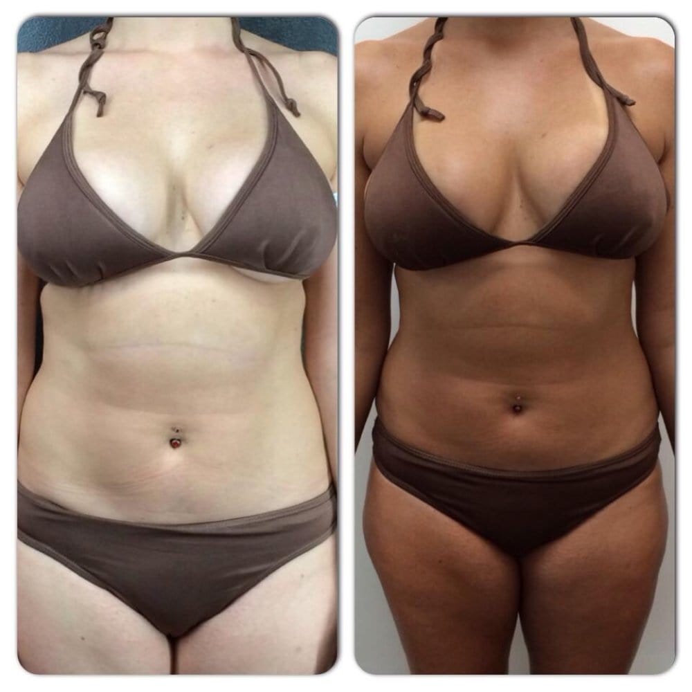 Luxoria® Natural Intensive Tanning Gel