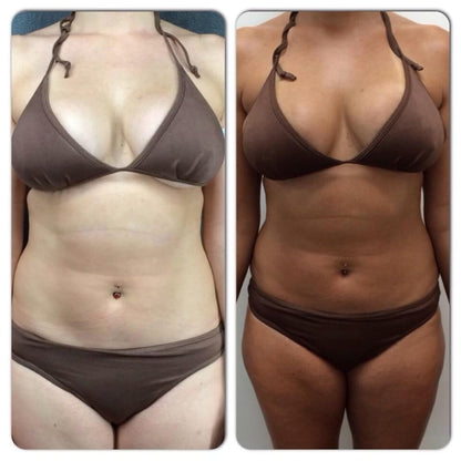 Luxoria® Natural Intensive Tanning Gel